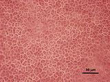 3 - cellule corticali in visione superficiale